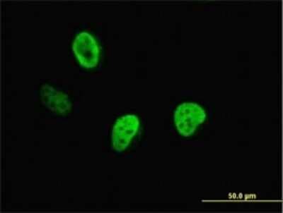 Immunocytochemistry/ Immunofluorescence: CDP/CUTL1 Antibody (2A10) [H00001523-M01]