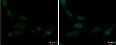 Immunocytochemistry/ Immunofluorescence: CDP/CUTL1 Antibody [NBP2-16039]
