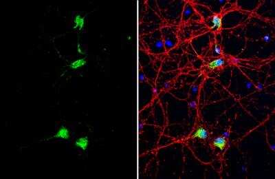 Immunocytochemistry/ Immunofluorescence: CDP/CUTL1 Antibody [NBP2-16039]
