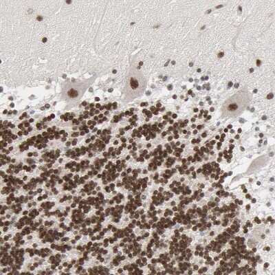 Immunohistochemistry-Paraffin: CDP/CUTL1 Antibody [NBP1-88187]