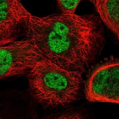 Immunocytochemistry/ Immunofluorescence: CDR2 Antibody [NBP1-84561]
