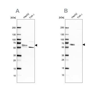 Western Blot: CDR2 Antibody [NBP1-84562]