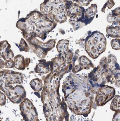Immunohistochemistry-Paraffin: CDR2L Antibody [NBP1-93681]
