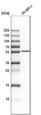 Western Blot: CDR2L Antibody [NBP1-93681]