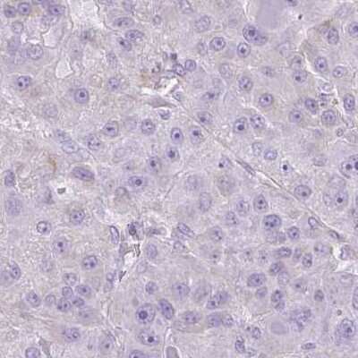 Immunohistochemistry-Paraffin: CDRT15 Antibody [NBP2-34174]