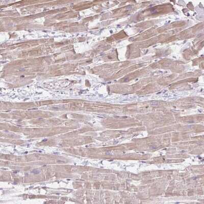 Immunohistochemistry-Paraffin: CDRT15 Antibody [NBP2-34174]