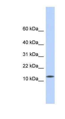 Western Blot: CDRT4 Antibody [NBP1-55440]