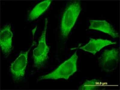 Immunocytochemistry/ Immunofluorescence: CDS1 Antibody (2D10) [H00001040-M01]