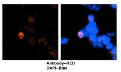 Immunocytochemistry/ Immunofluorescence: CDT1 Antibody [NBP1-58114]