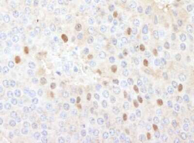 Immunohistochemistry-Paraffin: CDT1 Antibody [NB100-2567]