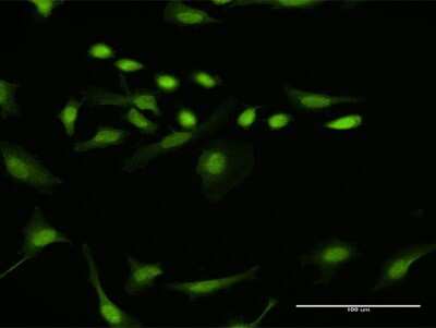 Immunocytochemistry/ Immunofluorescence: CDT2 Antibody [H00051514-D01P]