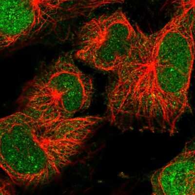 Immunocytochemistry/ Immunofluorescence: CDT2 Antibody [NBP2-58215]