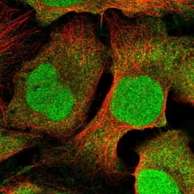 Immunocytochemistry/ Immunofluorescence: CDT2 Antibody [NBP2-58216]