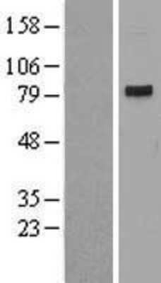 Western Blot: CDT2 Overexpression Lysate [NBL1-10031]