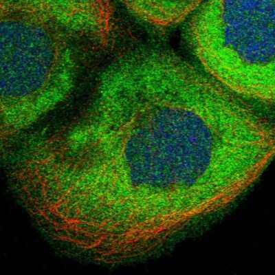 Immunocytochemistry/ Immunofluorescence: CDV3 Antibody [NBP1-81781]
