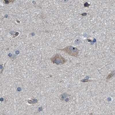 Immunohistochemistry-Paraffin: CDV3 Antibody [NBP1-81779]