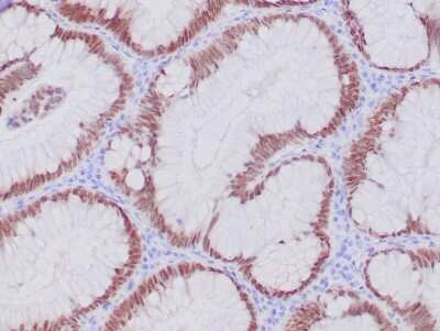 Immunohistochemistry-Paraffin: CDX2 Antibody (CDX2/4394R) [NBP3-07446]