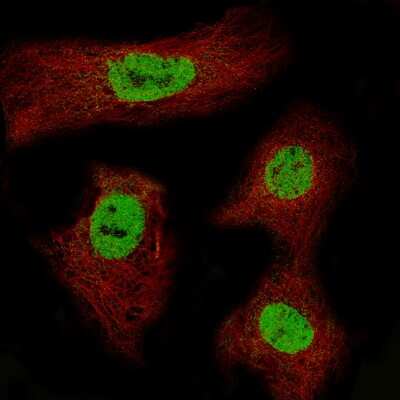 Immunocytochemistry/ Immunofluorescence: CDX2 Antibody (CL12967) [NBP3-18571]