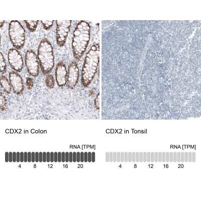 Immunohistochemistry-Paraffin: CDX2 Antibody (CL12967) [NBP3-18571]