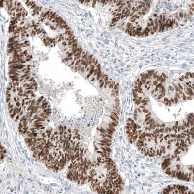Immunohistochemistry-Paraffin: CDX2 Antibody (CL12967) [NBP3-18571]