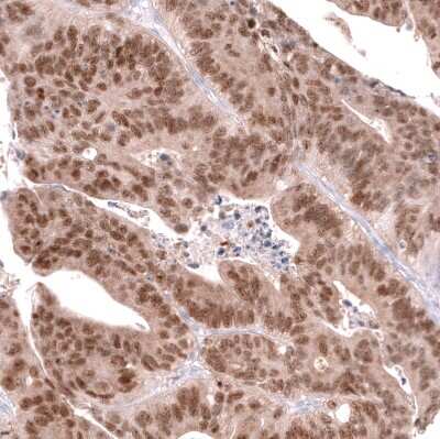 Immunohistochemistry-Paraffin: CDX2 Antibody (CL12967) [NBP3-18571]
