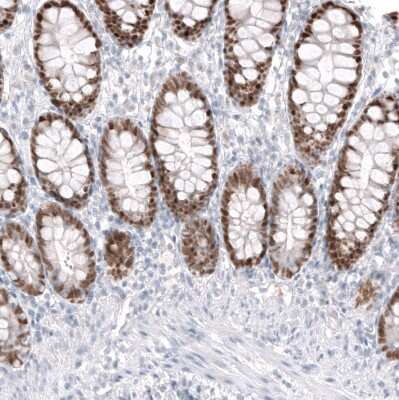 Immunohistochemistry-Paraffin: CDX2 Antibody (CL12967) [NBP3-18571]