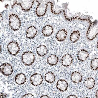 Immunohistochemistry-Paraffin: CDX2 Antibody (CL12967) [NBP3-18571]