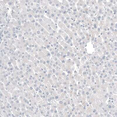 Immunohistochemistry-Paraffin: CDX2 Antibody (CL12967) [NBP3-18571]