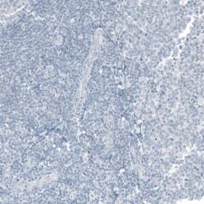 Immunohistochemistry-Paraffin: CDX2 Antibody (CL12967) [NBP3-18571]