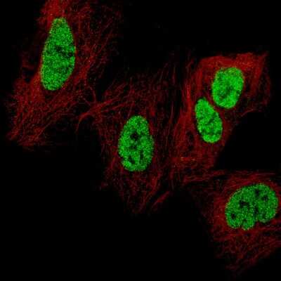 Immunocytochemistry/ Immunofluorescence: CDX2 Antibody (CL12974) [NBP3-18552]
