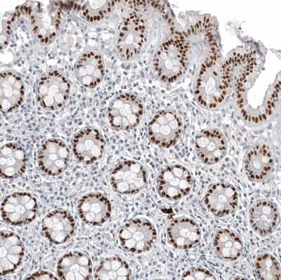 Immunohistochemistry-Paraffin: CDX2 Antibody (CL12974) [NBP3-18552]