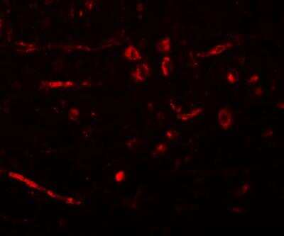 Immunocytochemistry/ Immunofluorescence: CDX2 Antibody - BSA Free [NBP1-77113]
