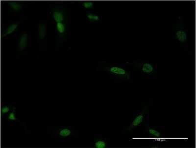 Immunocytochemistry/ Immunofluorescence: CDX4 Antibody (1E9) [H00001046-M12]