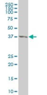 Western Blot: CDX4 Antibody (1E9) [H00001046-M12]
