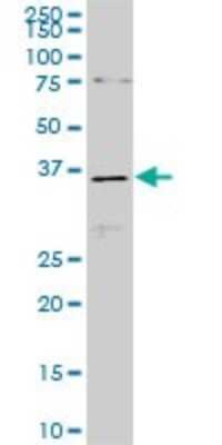 Western Blot: CDX4 Antibody (3F3) [H00001046-M06]