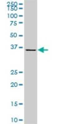 Western Blot: CDX4 Antibody (3F3) [H00001046-M06]
