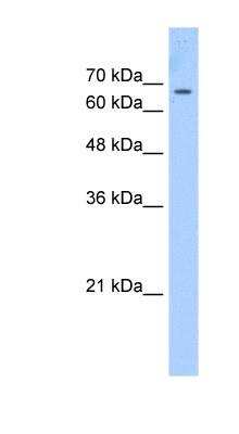 Western Blot: CDY1 Antibody [NBP2-88834]