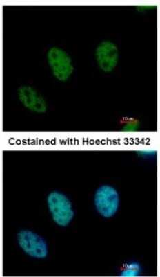 Immunocytochemistry/ Immunofluorescence: CDYL Antibody [NBP2-15851]