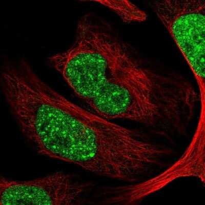 Immunocytochemistry/ Immunofluorescence: CDYL Antibody [NBP2-34011]