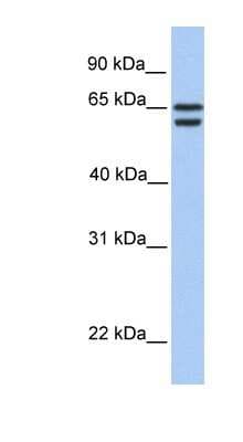 Western Blot: CDYL2 Antibody [NBP1-55178]