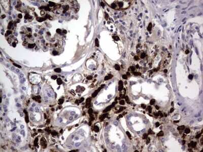 Immunohistochemistry: CEACAM5/CD66e Antibody (OTI3D8) [NBP2-46231]