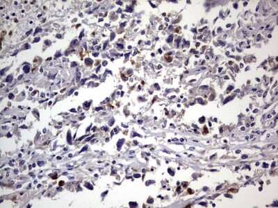 Immunohistochemistry: CEACAM5/CD66e Antibody (OTI3D8) [NBP2-46231]