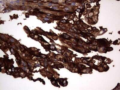 Immunohistochemistry: CEACAM5/CD66e Antibody (OTI3D8) [NBP2-46231]