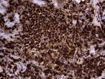Immunohistochemistry: CEACAM5/CD66e Antibody (OTI3D8) [NBP2-46231]