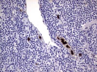 Immunohistochemistry: CEACAM5/CD66e Antibody (OTI3D8) [NBP2-46231]