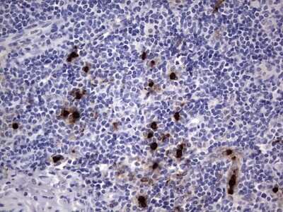 Immunohistochemistry: CEACAM5/CD66e Antibody (OTI3D8) [NBP2-46231]