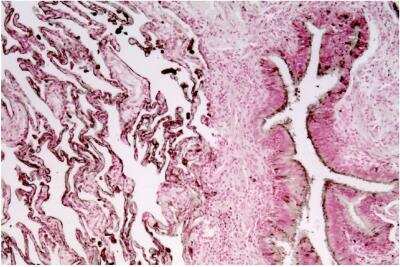 Immunohistochemistry: CEACAM6/CD66c Antibody (1H7-4B) - BSA Free [NBP2-54626]