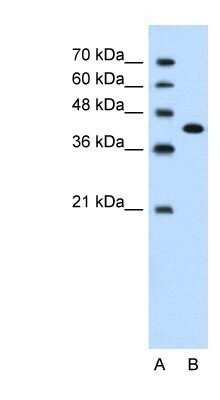 Western Blot: CEACAM6/CD66c Antibody [NBP1-55290]