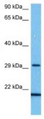 Western Blot: CEACAM10 Antibody [NBP3-10158]