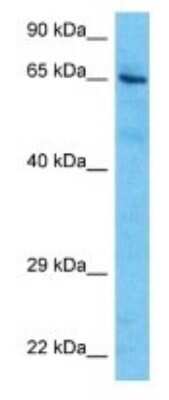 Western Blot: CEACAM20 Antibody [NBP3-09600]